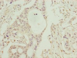 Invitrogen C8B Polyclonal Antibody 100 &mu;L; Unconjugated:Antibodies,