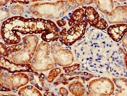 Invitrogen Carbonic Anhydrase XII Polyclonal Antibody 100 &mu;g; Unconjugated:Antibodies,