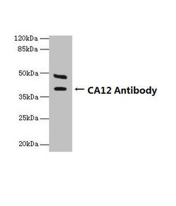 Invitrogen Carbonic Anhydrase XII Polyclonal Antibody 100 &mu;g; Unconjugated:Antibodies,