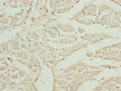 Invitrogen CAP2 Polyclonal Antibody 100 &mu;g; Unconjugated:Antibodies,