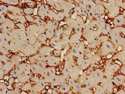 Invitrogen CAP2 Polyclonal Antibody 100 &mu;g; Unconjugated:Antibodies,