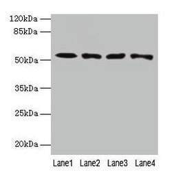 Invitrogen CAP2 Polyclonal Antibody 100 &mu;g; Unconjugated:Antibodies,