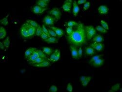 Invitrogen Calpain 2 Polyclonal Antibody 100 &mu;g; Unconjugated:Antibodies,