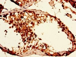 Invitrogen CAPZA1 Polyclonal Antibody 100 &mu;g; Unconjugated:Antibodies,