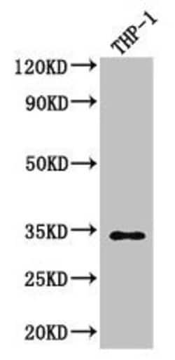 Invitrogen CAPZA1 Polyclonal Antibody 100 &mu;g; Unconjugated:Antibodies,