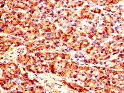 Invitrogen CARS Polyclonal Antibody 100 &mu;g; Unconjugated:Antibodies,