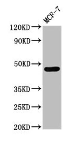 Invitrogen Calsequestrin 2 Polyclonal Antibody 100 &mu;g; Unconjugated:Antibodies,