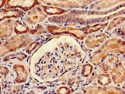 Invitrogen YARS Polyclonal Antibody 100 &mu;g | Buy Online | Invitrogen&trade; | Fisher Scientific