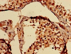 Invitrogen YARS Polyclonal Antibody 100 &mu;g | Buy Online | Invitrogen&trade; | Fisher Scientific