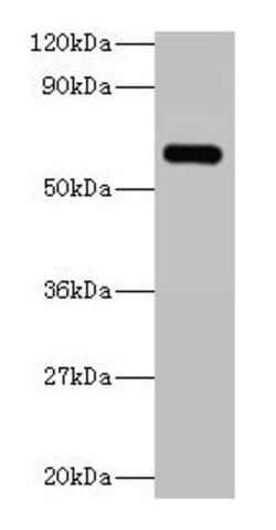 Invitrogen YARS Polyclonal Antibody 100 &mu;g | Buy Online | Invitrogen&trade; | Fisher Scientific