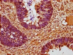 Invitrogen Cyclin D2 Polyclonal Antibody 100 &mu;L; Unconjugated:Antibodies,