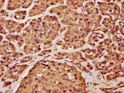 Invitrogen Cyclin D2 Polyclonal Antibody 100 &mu;L; Unconjugated:Antibodies,