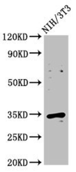 Invitrogen Cyclin D2 Polyclonal Antibody 100 &mu;L; Unconjugated:Antibodies,