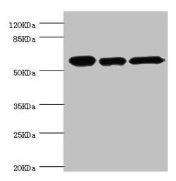 Invitrogen TCP-1 beta Polyclonal Antibody 100 &mu;L | Buy Online | Invitrogen&trade; | Fisher Scientific