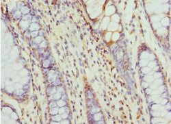 Invitrogen TCP-1 epsilon Polyclonal Antibody 100 &mu;L | Buy Online | Invitrogen&trade; | Fisher Scientific
