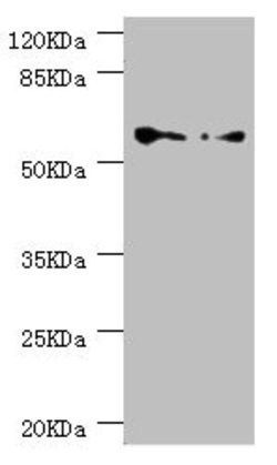Invitrogen TCP-1 epsilon Polyclonal Antibody 100 &mu;L | Buy Online | Invitrogen&trade; | Fisher Scientific