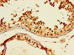 Invitrogen TCP-1 theta Polyclonal Antibody 100 &mu;g; Unconjugated:Antibodies,