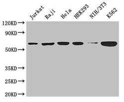 Invitrogen TCP-1 theta Polyclonal Antibody 100 &mu;g; Unconjugated:Antibodies,