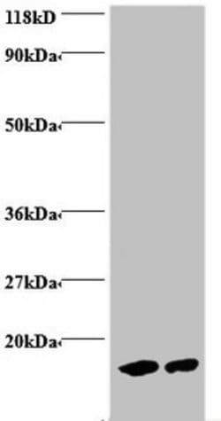 Invitrogen Hemoglobin Polyclonal Antibody 100 &mu;g | Buy Online | Invitrogen&trade; | Fisher Scientific