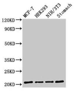 Invitrogen CD3g Polyclonal Antibody 100 &mu;g; Unconjugated:Antibodies,