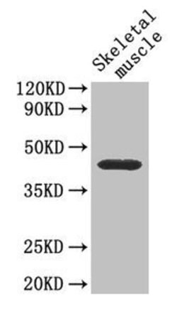 Invitrogen CD46 Polyclonal Antibody 100 &mu;g | Buy Online | Invitrogen&trade; | Fisher Scientific