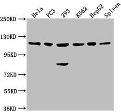 Invitrogen CDKL5 Polyclonal Antibody 100 &mu;L; Unconjugated:Antibodies,