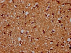 Invitrogen CDS2 Polyclonal Antibody 100 &mu;g; Unconjugated:Antibodies,