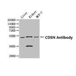 Invitrogen CDSN Polyclonal Antibody 100 &mu;g | Buy Online | Invitrogen&trade; | Fisher Scientific