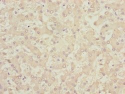 Invitrogen CENPK Polyclonal Antibody 100 &mu;L | Buy Online | Invitrogen&trade; | Fisher Scientific
