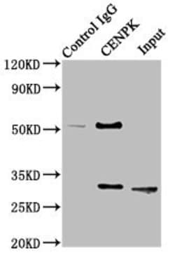 Invitrogen CENPK Polyclonal Antibody 100 &mu;L | Buy Online | Invitrogen&trade; | Fisher Scientific