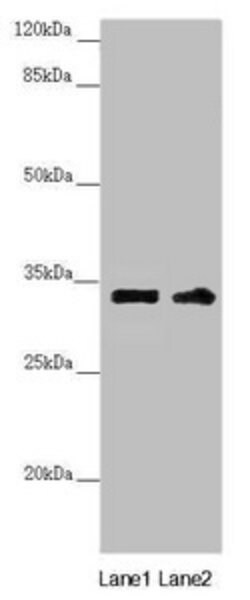 Invitrogen CENPK Polyclonal Antibody 100 &mu;L | Buy Online | Invitrogen&trade; | Fisher Scientific