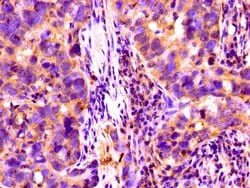 Invitrogen Complement Factor I Polyclonal Antibody 100 &mu;g; Unconjugated:Antibodies,