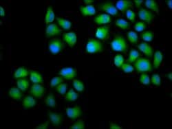 Invitrogen Chondrolectin Polyclonal Antibody 100 &mu;g; Unconjugated:Antibodies,