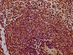 Invitrogen Chondrolectin Polyclonal Antibody 100 &mu;g; Unconjugated:Antibodies,