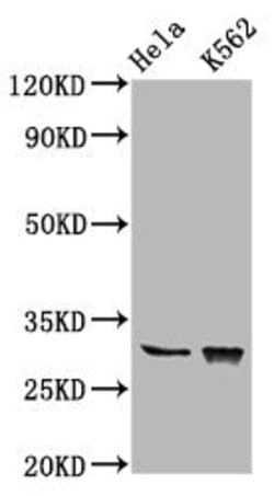Invitrogen Chondrolectin Polyclonal Antibody 100 &mu;g; Unconjugated:Antibodies,