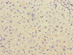 Invitrogen CHRNE Polyclonal Antibody 100 &mu;L; Unconjugated:Antibodies,