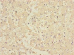 Invitrogen CHRNE Polyclonal Antibody 100 &mu;L; Unconjugated:Antibodies,