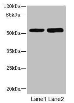 Invitrogen CHRNE Polyclonal Antibody 100 &mu;L; Unconjugated:Antibodies,