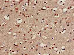 Invitrogen CHST1 Polyclonal Antibody 100 &mu;g; Unconjugated:Antibodies,
