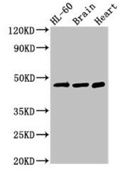 Invitrogen CHST1 Polyclonal Antibody 100 &mu;g; Unconjugated:Antibodies,