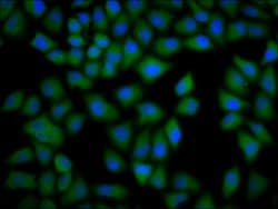 Invitrogen CKAP4 Polyclonal Antibody 100 &mu;g; Unconjugated:Antibodies,