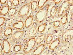 Invitrogen CLEC18A Polyclonal Antibody 100 &mu;g | Buy Online | Invitrogen&trade; | Fisher Scientific