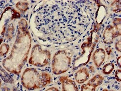 Invitrogen CLEC18A Polyclonal Antibody 100 &mu;g | Buy Online | Invitrogen&trade; | Fisher Scientific