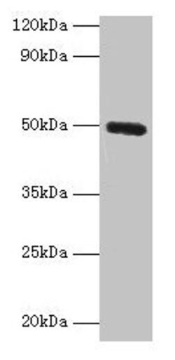 Invitrogen CLEC18A Polyclonal Antibody 100 &mu;g | Buy Online | Invitrogen&trade; | Fisher Scientific