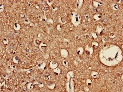 Invitrogen CLEC3A Polyclonal Antibody 100 &mu;g; Unconjugated:Antibodies,