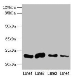 Invitrogen CLEC3A Polyclonal Antibody 100 &mu;g; Unconjugated:Antibodies,