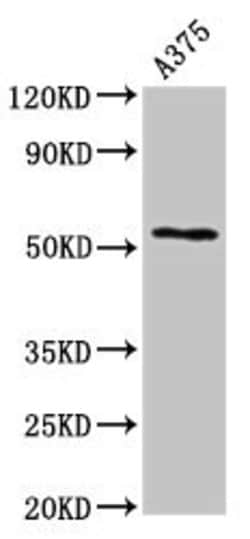 Invitrogen Carboxypeptidase E Polyclonal Antibody 100 &mu;g | Buy Online | Invitrogen&trade; | Fisher Scientific