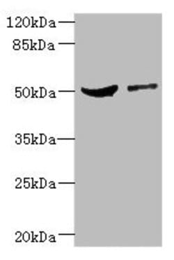 Invitrogen CPN1 Polyclonal Antibody 100 &mu;L; Unconjugated:Antibodies,