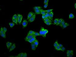 Invitrogen CPS1 Polyclonal Antibody 100 &mu;g; Unconjugated:Antibodies,