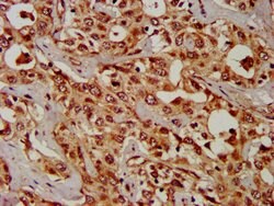 Invitrogen CPS1 Polyclonal Antibody 100 &mu;g; Unconjugated:Antibodies,